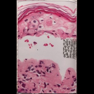 Cover DERMA